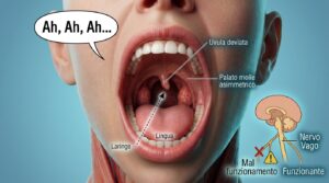 Test Ugola per disfunzione del nervo vago